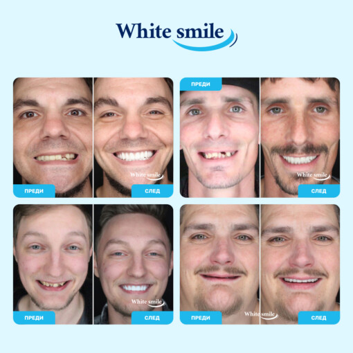 Изкуствени зъби WhiteSmile - Image 3