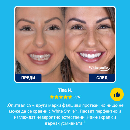 Изкуствени зъби WhiteSmile - Image 7