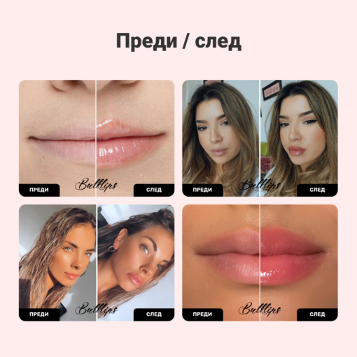 BULKLIPS Ginger and Mint Plumper Lip Set - Image 2